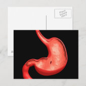 Conceptueel Afbeelding van eptische ulcera in buik Briefkaart (Voorkant / Achterkant)
