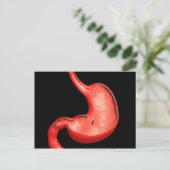 Conceptueel Afbeelding van eptische ulcera in buik Briefkaart (Staand voorkant)