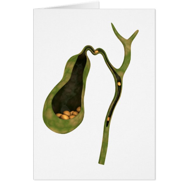 Conceptueel Afbeelding van galstenen in galgen (Voorkant)