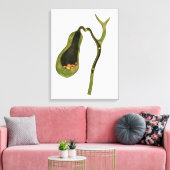 Conceptueel Afbeelding van galstenen in galgen Canvas Afdruk (Insitu (Woonkamer))