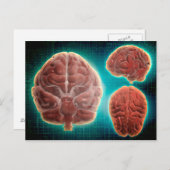 Conceptueel Afbeelding van het menselijk brein op Briefkaart (Voorkant / Achterkant)