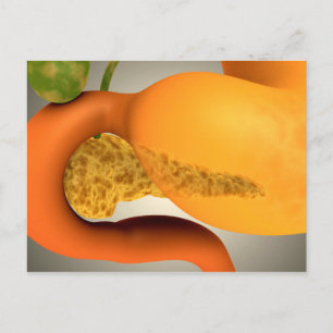 Conceptueel Afbeelding van menselijke pancreas en Briefkaart