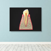 Conceptueel Afbeelding van menselijke tanden 2 Canvas Afdruk (Insitu (Houten vloer))