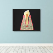 Conceptueel Afbeelding van menselijke tanden 2 Canvas Afdruk (Insitu (Houten vloer))