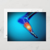 Conceptueel Afbeelding van pijn bij de mens Briefkaart (Voorkant / Achterkant)