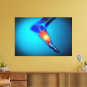 Conceptueel Afbeelding van pijn bij de mens Canvas Afdruk (Insitu (Woonkamer))