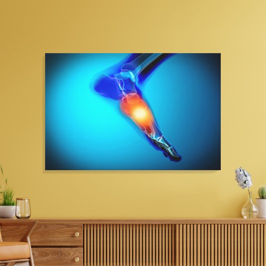 Conceptueel Afbeelding van pijn bij de mens Canvas Afdruk (Insitu (Woonkamer))