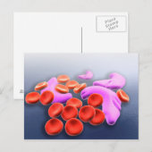 Conceptueel Afbeelding van sikkelcelanemie Briefkaart (Voorkant / Achterkant)