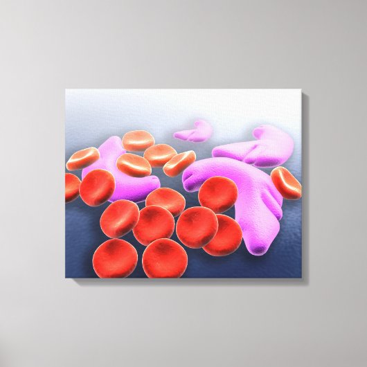 Conceptueel Afbeelding van sikkelcelanemie Canvas Afdruk (Voorkant)