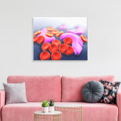 Conceptueel Afbeelding van sikkelcelanemie Canvas Afdruk (Insitu (Woonkamer))