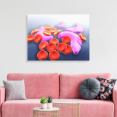 Conceptueel Afbeelding van sikkelcelanemie Canvas Afdruk (Insitu (Woonkamer))