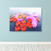 Conceptueel Afbeelding van sikkelcelanemie Canvas Afdruk (Insitu (Houten vloer))