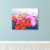 Conceptueel Afbeelding van sikkelcelanemie Canvas Afdruk (Insitu (Houten vloer))
