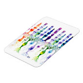 Cone-cellen en bipolaire neurond van het netvlies magneet (Linkerzijde)