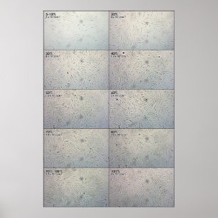Confluence follow-up Chart Poster