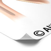 Conventionele versus omgekeerde totale schouderver poster (Hoek)