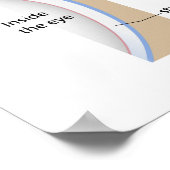 Corneusulcus oogaandoening Poster (Hoek)