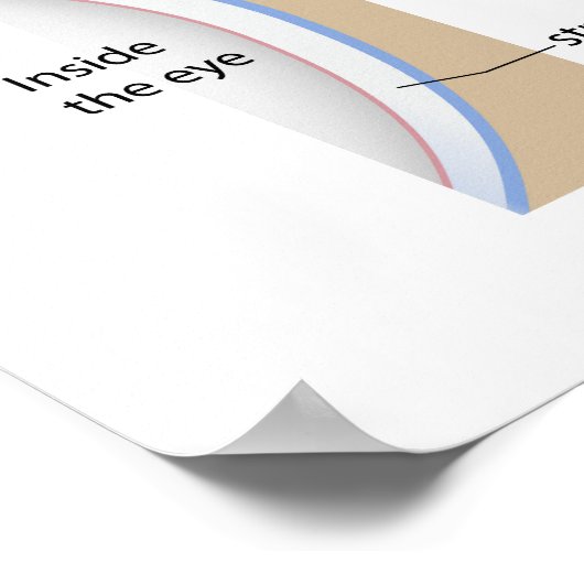 Corneusulcus oogaandoening Poster (Hoek)