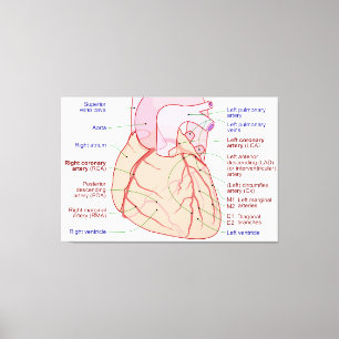Coronaire Arterieën Circulatie Diagram Menselijk H Canvas Afdruk