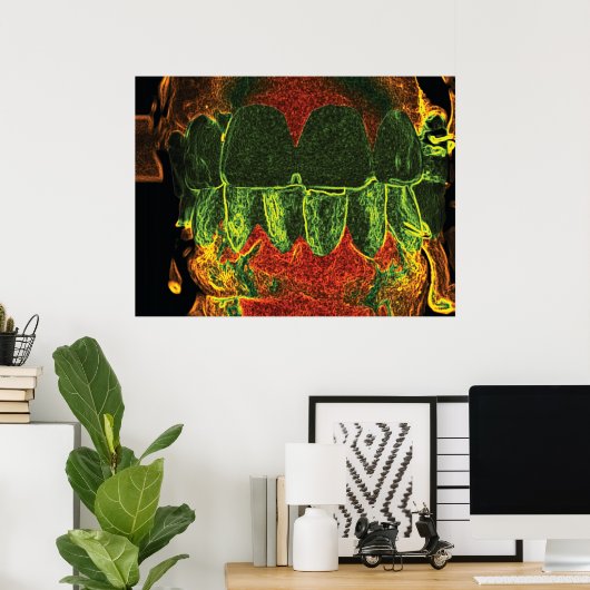 Crazy Teeth Bite Dentist Orthodontist Poster (Thuiskantoor)