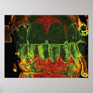Crazy Teeth Bite Dentist Orthodontist Poster