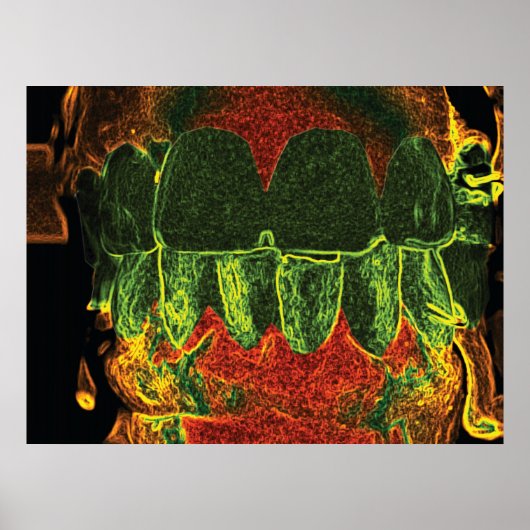 Crazy Teeth Bite Dentist Orthodontist Poster (Voorkant)