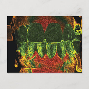 Crazy Teeth Model Design Tandarts Orthodontist Kaa Briefkaart