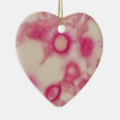 Cryptokokken-Ornament Keramisch Ornament (Rechts)