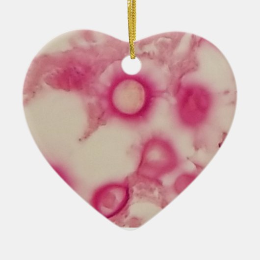 Cryptokokken-Ornament Keramisch Ornament (Voorkant)