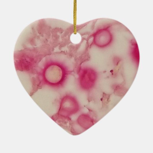 Cryptokokken-Ornament Keramisch Ornament (Achterkant)