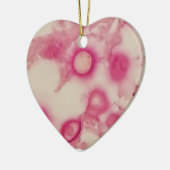 Cryptokokken-Ornament Keramisch Ornament (Links)