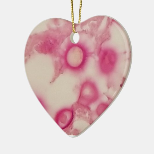 Cryptokokken-Ornament Keramisch Ornament (Links)