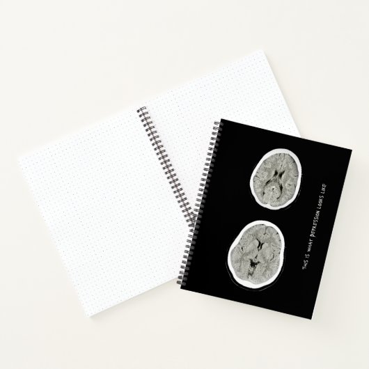 CT Scan_CTFOD_ Zo ziet een depressie eruit Notitieboek (Binnen)