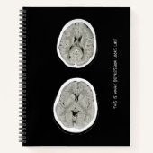 CT Scan_CTFOD_ Zo ziet een depressie eruit Notitieboek (Voorkant)