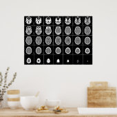 CT SCAN HEAD POSTER (Keuken)