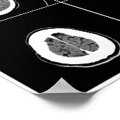 CT SCAN HEAD POSTER (Hoek)
