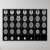 CT SCAN HEAD POSTER (Voorkant)