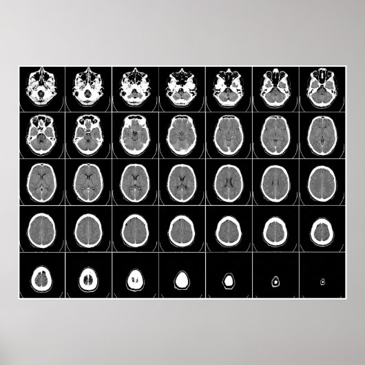 CT SCAN HEAD POSTER (Voorkant)