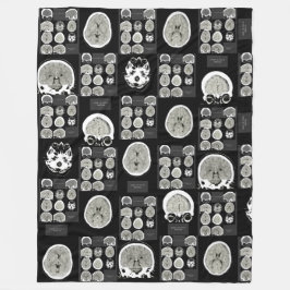 CT Scan_this is depressie_BLK_CTFOD Fleece Deken