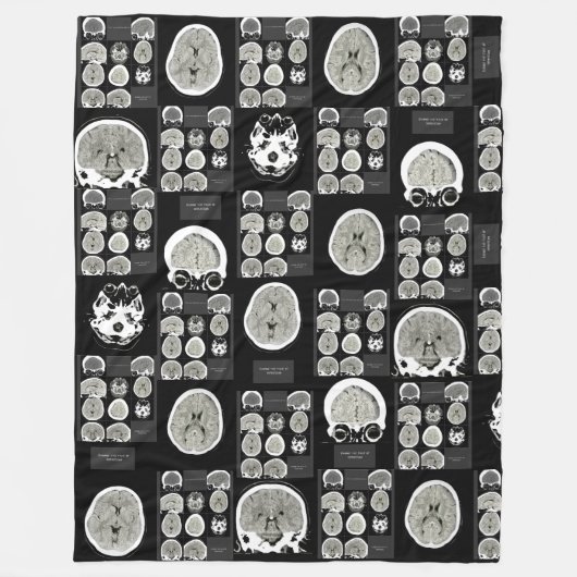 CT Scan_this is depressie_BLK_CTFOD Fleece Deken (Voorkant)