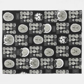 CT Scan_this is depressie_BLK_CTFOD Fleece Deken (Voorkant (Horizontaal))