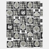 CT Scan_this is depressie_CTFOD Fleece Deken (Voorkant)