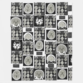 CT Scan_this is depressie_CTFOD Fleece Deken