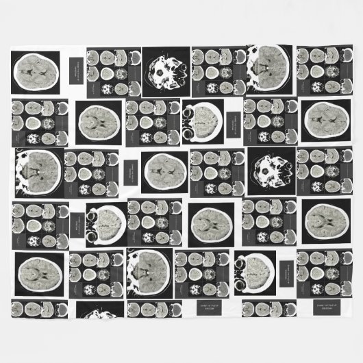 CT Scan_this is depressie_CTFOD Fleece Deken (Voorkant (Horizontaal))