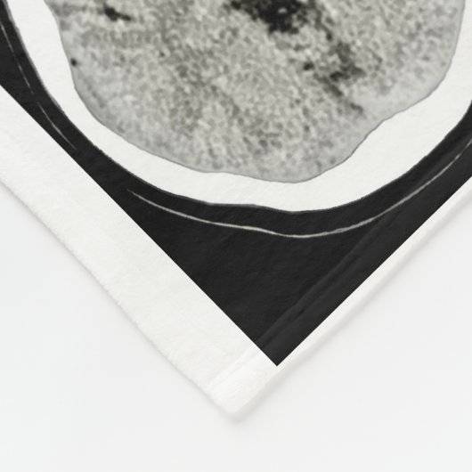 CT Scan_this is depressie_CTFOD Fleece Deken (Hoek)