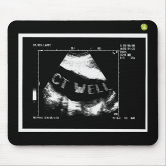 CT Well Mousepade  (CT Well im Bauch) Muismat