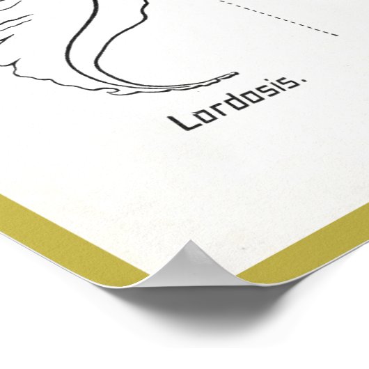 Curven van het Poster van de wervelkolom (Hoek)