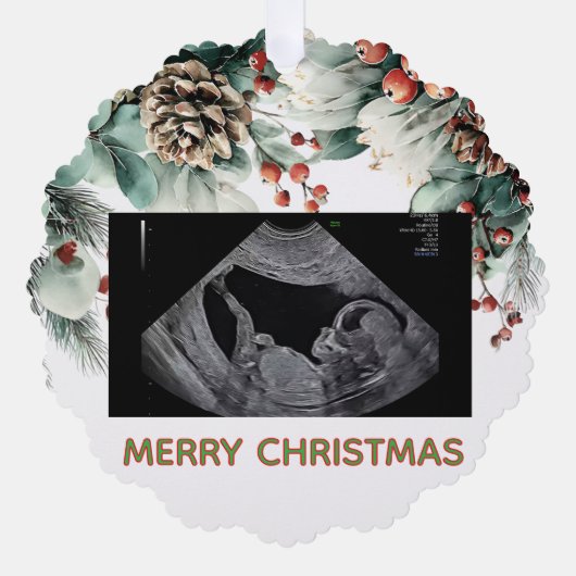 Custom First Christmas Expecting Photo Ornament (Voorkant)
