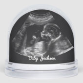 Custom Sonogram Zwangerschap Echografie Foto Sneeuwbol (Voorkant)