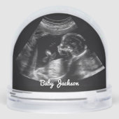 Custom Sonogram Zwangerschap Echografie Foto Sneeuwbol (Achterkant)